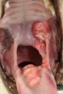 Diseases of the cat mouth